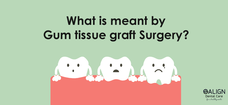 What is meant by Gum tissue graft surgery