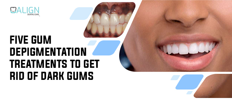 Five gum depigmentation treatments to get rid of dark gums