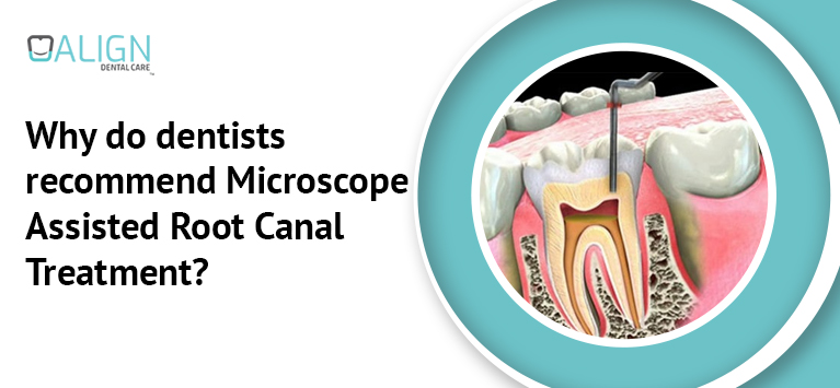 Why do dentists recommend Microscope-assisted Root Canal Treatment?