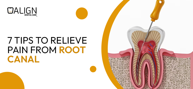 7 Tips to Relieve Pain from Root Canal