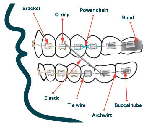 orthodontic