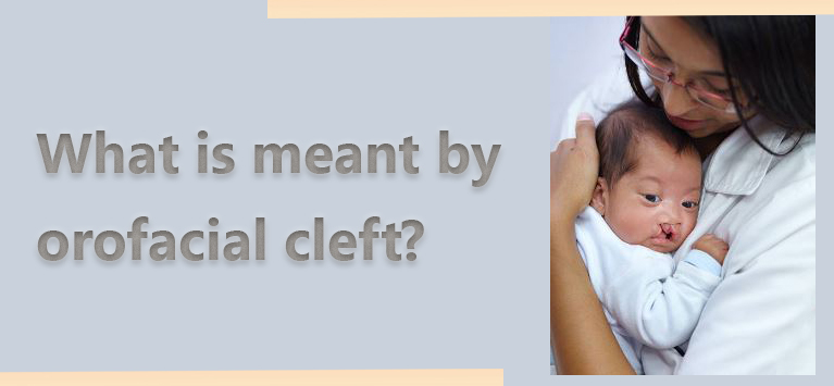 baby with orofacial cleft