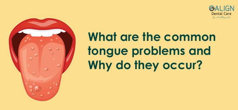 What are the common tongue Problems