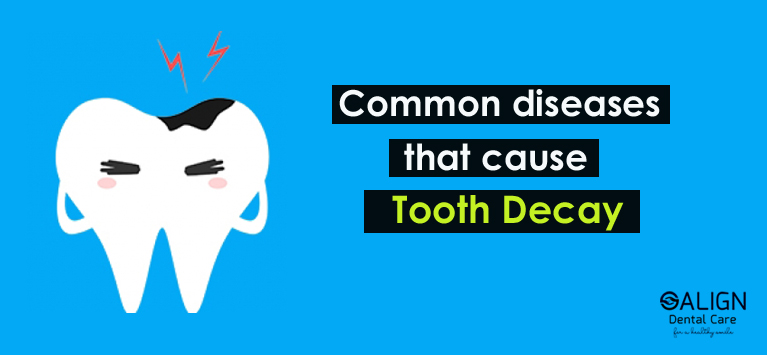 Common diseases that cause tooth decay