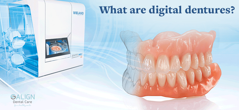 What are digital dentures