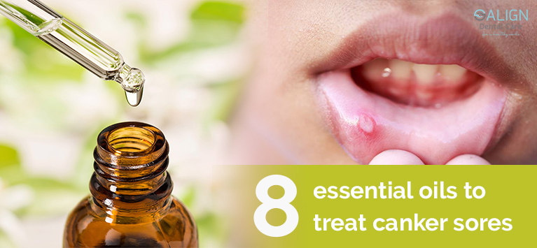 8 essential oils to treat canker sores