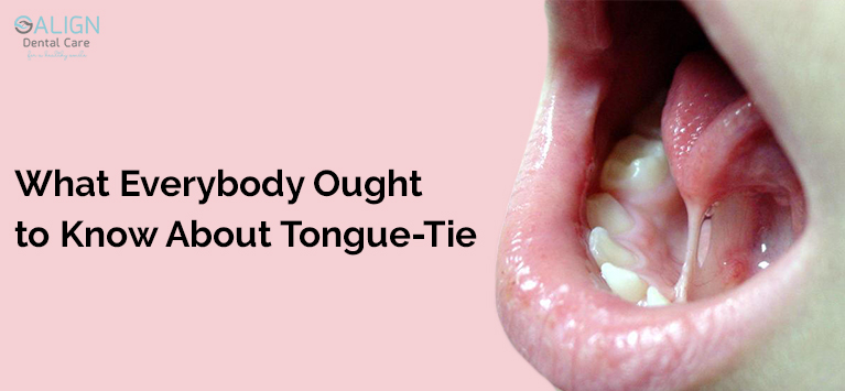 What Everybody Ought to Know About Tongue-Tie