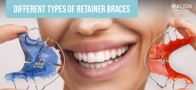 Different types of retainer braces