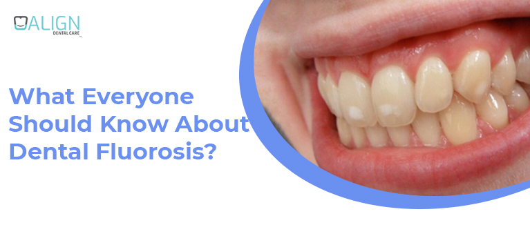 What everyone should know about dental fluorosis