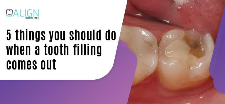 5 things you should do when a tooth filling comes out