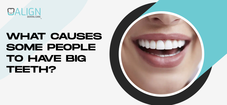 What causes some people to have big teeth