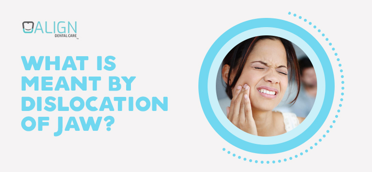 What is meant by dislocation of jaw?
