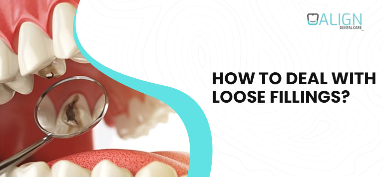 How to deal with loose fillings?