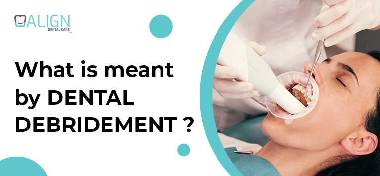 What is meant by dental debridement?