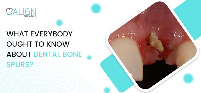 What everybody ought to know about dental bone spurs?