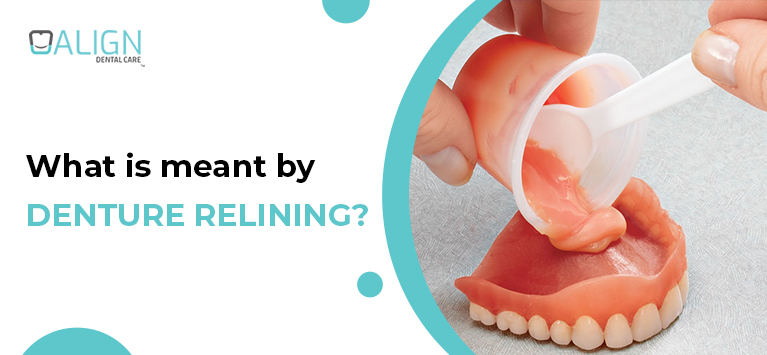 What is meant by Denture Relining?