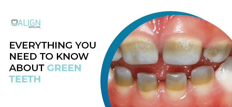 Everything You Need to Know About Green Teeth