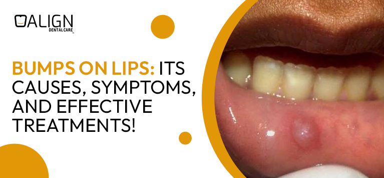 Bumps on Lips: Its Causes, Symptoms, and Effective Treatments!