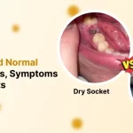 Dry Socket and Normal Socket