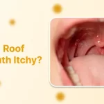 Why Is the Roof of My Mouth Itchy