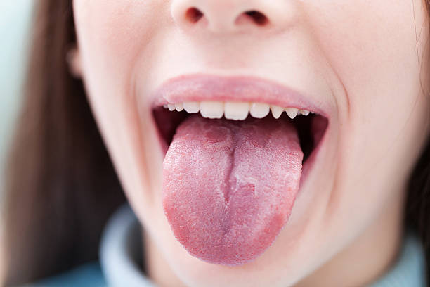 itchy roof of mouth due to Infections and Oral Conditions