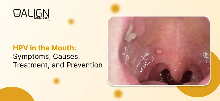 HPV in the Mouth